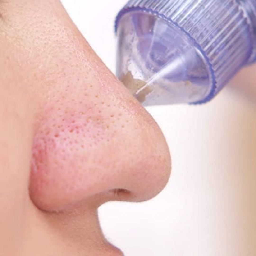 Derma Suction